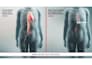 create 3d medical animation cardiovascular tavr heart aortic valve visualization
